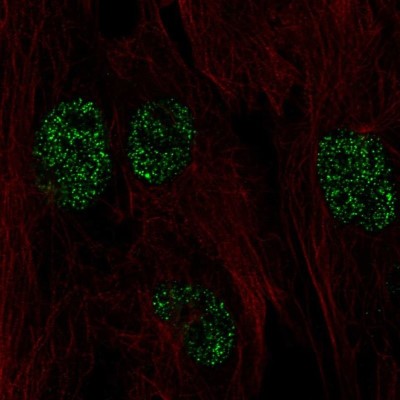 Immunocytochemistry/Immunofluorescence: HYPE Antibody [NBP2-58855] - Staining of human cell line BJ shows localization to nucleus.