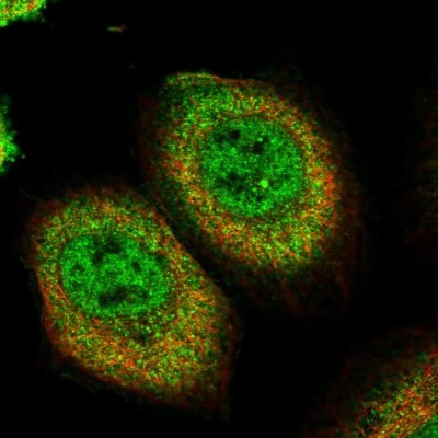 Immunocytochemistry/Immunofluorescence: PEPP2 Antibody [NBP2-58961] - Staining of human cell line A-431 shows localization to nucleoplasm & cytosol.