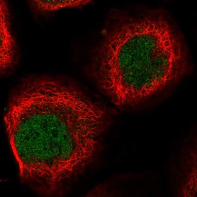 Immunocytochemistry/Immunofluorescence: EID2 Antibody [NBP1-94096] - Immunofluorescent staining of human cell line A-431 shows localization to nucleoplasm.