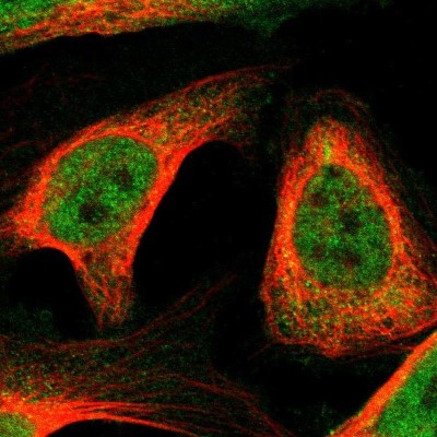 Immunocytochemistry/Immunofluorescence: BRWD3 Antibody [NBP1-93796] - Immunofluorescent staining of human cell line U-2 OS shows localization to nucleoplasm & cytosol.