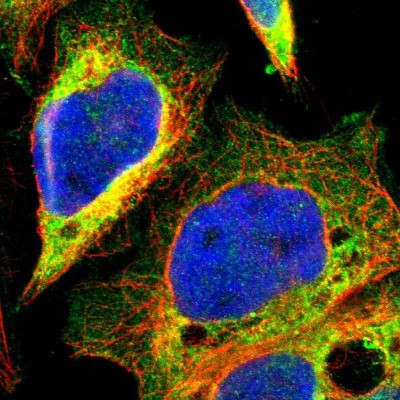 Immunocytochemistry/Immunofluorescence: MOSPD2 Antibody [NBP1-93499] - Immunofluorescent staining of human cell line A-431 shows localization to endoplasmic reticulum.