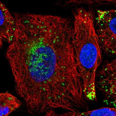Immunocytochemistry/Immunofluorescence: HIG2 Antibody [NBP1-93960] - Staining of human cell line A549 shows localization to nucleoplasm & lipid droplets.