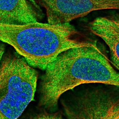 Immunocytochemistry/Immunofluorescence: DNAJA4 Antibody [NBP2-58975] - Staining of human cell line U-2 OS shows localization to plasma membrane & cytosol.
