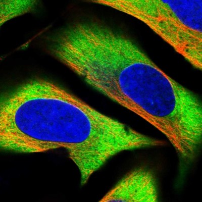 Immunocytochemistry/Immunofluorescence: GPIP137 Antibody [NBP1-88195] - Immunofluorescent staining of human cell line U-2 OS shows localization to cytosol.