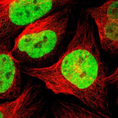 Immunocytochemistry/Immunofluorescence: ZNF828 Antibody [NBP1-88402] - Immunofluorescent staining of human cell line U-2 OS shows localization to nucleoplasm.