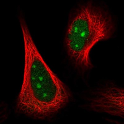 Immunocytochemistry/Immunofluorescence: GRWD1 Antibody [NBP2-56888] - Staining of human cell line U-2 OS shows localization to nucleus & nucleoli.