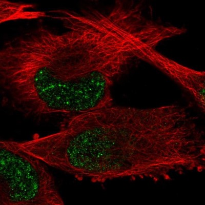 Immunocytochemistry/Immunofluorescence: GTF2H2 Antibody [NBP2-56841] - Staining of human cell line U-251 MG shows localization to nuclear speckles.