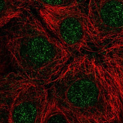 Immunocytochemistry/Immunofluorescence: RNASEH2C Antibody [NBP2-56902] - Staining of human cell line MCF7 shows localization to nucleus.