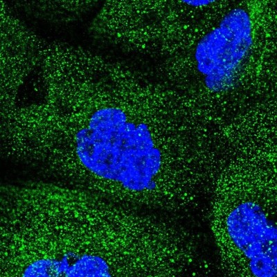 Immunocytochemistry/Immunofluorescence: COQ2 Antibody [NBP2-56780] - Staining of human cell line A-431 shows localization to cytosol.