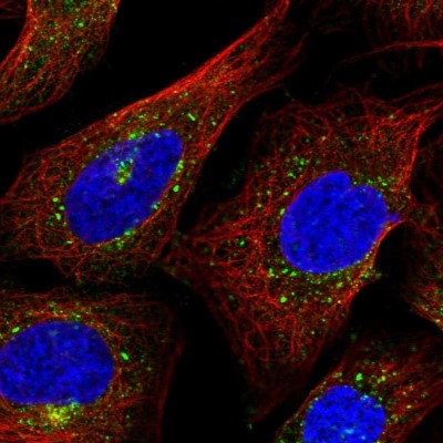 Immunocytochemistry/Immunofluorescence: Gamma Adaptin Antibody [NBP2-58947] - Staining of human cell line U-2 OS shows localization to vesicles.