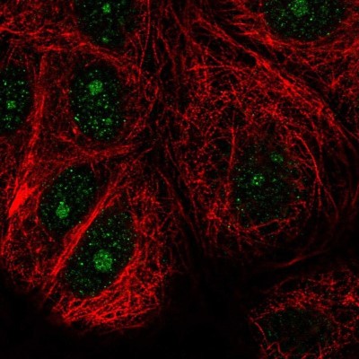 Immunocytochemistry/Immunofluorescence: NUDT16 Antibody [NBP2-37976] - Staining  of human cell line MCF7 shows positivity in nucleus and nucleoli.
