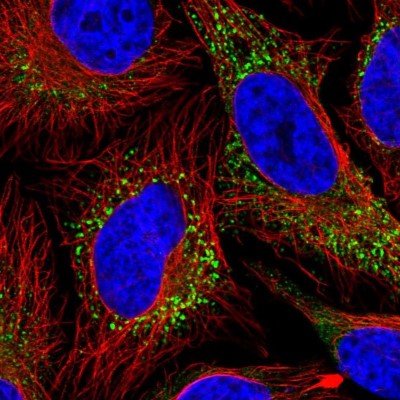 Immunocytochemistry/Immunofluorescence: Collagen V Antibody [NBP2-38162] - Immunofluorescent staining of human cell line HeLa shows localization to vesicles.