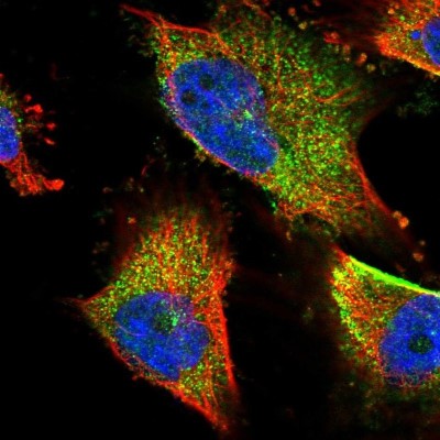 Immunocytochemistry/Immunofluorescence: TNPO3 Antibody [NBP2-58965] - Staining of human cell line U-251 MG shows localization to vesicles.