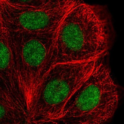 Immunocytochemistry/Immunofluorescence: DHX38 Antibody [NBP2-58971] - Staining of human cell line MCF7 shows localization to nucleus.