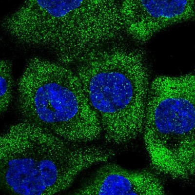 Immunocytochemistry/Immunofluorescence: RNF207 Antibody [NBP2-59015] - Staining of human cell line A-431 shows localization to cytosol.