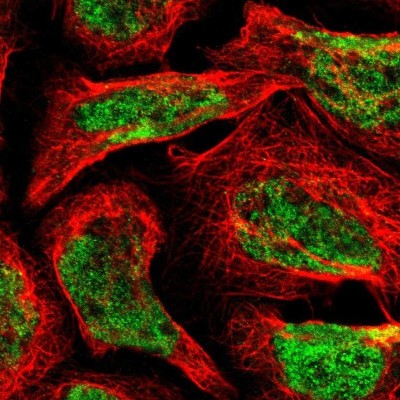 Immunocytochemistry/Immunofluorescence: FBXL6 Antibody [NBP2-58922] - Staining of human cell line A-431 shows localization to nucleus.