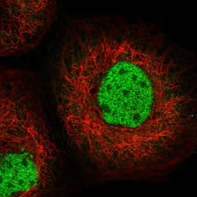 Immunocytochemistry/Immunofluorescence: SFMBT1 Antibody [NBP2-48652] - Immunofluorescent staining of human cell line A-431 shows localization to nucleoplasm.