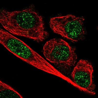Immunocytochemistry/Immunofluorescence: ZNF248 Antibody [NBP2-48538] - Staining of human cell line PC-3 shows localization to nucleoplasm.