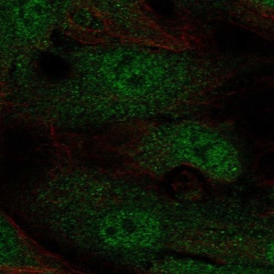 Immunocytochemistry/Immunofluorescence: Annexin 2 Receptor Antibody [NBP2-49008] - Staining of human cell line HUVEC TERT2 shows localization to nucleoplasm, cytosol & cytoplasmic bodies.