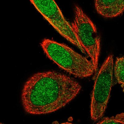 Immunocytochemistry/Immunofluorescence: TNIP2 Antibody [NBP2-48949] - Immunofluorescent staining of human cell line PC-3 shows localization to nucleus & cytosol.