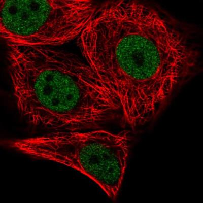 Immunocytochemistry/Immunofluorescence: PATZ Antibody [NBP2-48884] - Immunofluorescent staining of human cell line MCF7 shows localization to nucleoplasm. Antibody staining is shown in green.