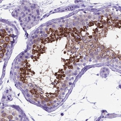 Immunohistochemistry-Paraffin: C16orf71 Antibody [NBP2-48935] - Staining of human testis shows strong cytoplasmic positivity in a subset of cells in seminiferous ducts.