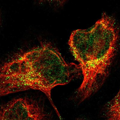 Immunocytochemistry/Immunofluorescence: TRIM65 Antibody [NBP1-86423] - Immunofluorescent staining of human cell line U-2 OS shows localization to nucleoplasm & vesicles.