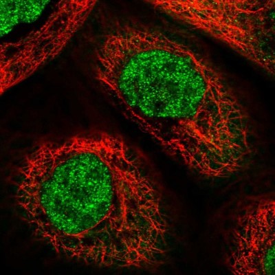 Immunocytochemistry/Immunofluorescence: glycerol-3-phosphate permease Antibody [NBP1-87524] - Immunofluorescent staining of human cell line A-431 shows localization to nucleoplasm & cytosol.