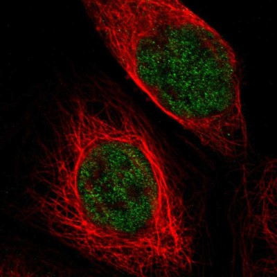 Immunocytochemistry/Immunofluorescence: TSPAN2 Antibody [NBP1-87397] - Immunofluorescent staining of human cell line A-431 shows localization to nucleoplasm.