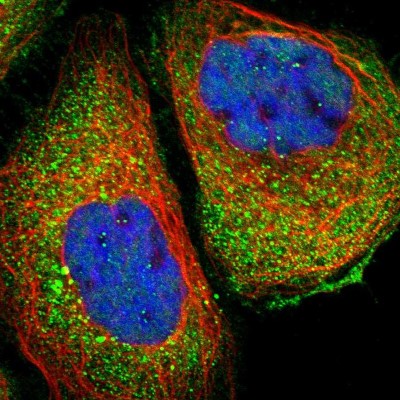 Immunocytochemistry/Immunofluorescence: COX19 Antibody [NBP1-82769] - Immunofluorescent staining of human cell line A-431 shows localization to cytosol.