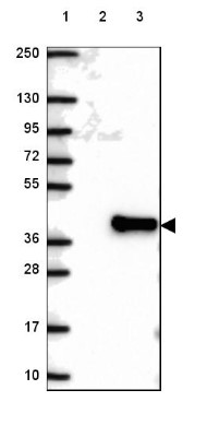 Western Blot: C1orf69 Antibody [NBP2-48594] - Lane 1: Marker [kDa] 250, 130, 95, 72, 55, 36, 28, 17, 10Lane 2: Negative control (vector only transfected HEK293T lysate)Lane 3: Over-expression lysate (Co-expressed with a C-terminal myc-DDK tag (~3.1 kDa) in mammalian HEK293T cells, LY423195)