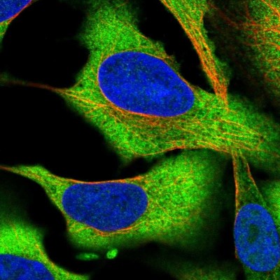Immunocytochemistry/Immunofluorescence: CCDC124 Antibody [NBP2-48858] - Immunofluorescent staining of human cell line U-2 OS shows localization to plasma membrane & cytosol.
