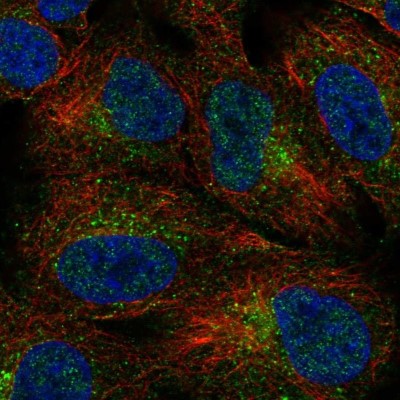 Immunocytochemistry/Immunofluorescence: Soggy-1/DkkL1 Antibody [NBP2-48868] - Staining of human cell line A549 shows localization to vesicles.