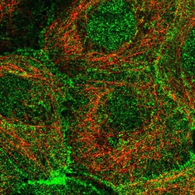 Immunocytochemistry/Immunofluorescence: Plakophilin-3 Antibody [NBP2-49379] - Staining of human cell line A-431 shows localization to nucleoplasm & cell junctions.