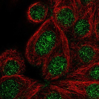 Immunocytochemistry/Immunofluorescence: DENND2C Antibody [NBP2-49159] - Immunofluorescent staining of human cell line MCF7 shows localization to nucleus & nucleoli.