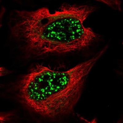 Immunocytochemistry/Immunofluorescence: DKFZp566F084 Antibody [NBP2-38312] - Immunofluorescent staining of human cell line U-2 OS shows localization to nuclear speckles.