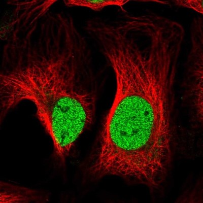 Immunocytochemistry/Immunofluorescence: ATP6V1D Antibody [NBP2-49254] - Analysis of human cell line U-2 OS shows positivity in nucleus but excluded from the nucleoli.