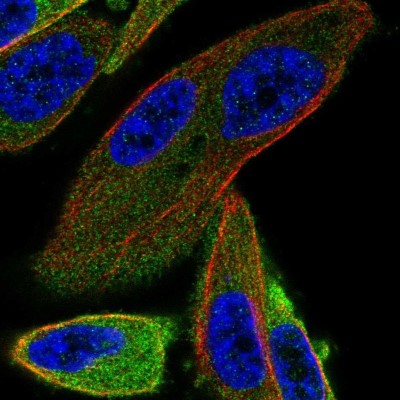 Immunocytochemistry/Immunofluorescence: ANKRD57 Antibody [NBP2-49215] - Immunofluorescent staining of human cell line PC-3 shows localization to cytosol.