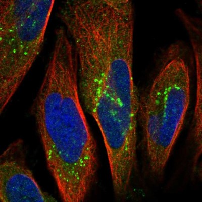 Immunocytochemistry/Immunofluorescence: OSBPL9 Antibody [NBP1-86390] - Staining of human cell line U-2 OS shows localization to cytosol, the Golgi apparatus & vesicles.