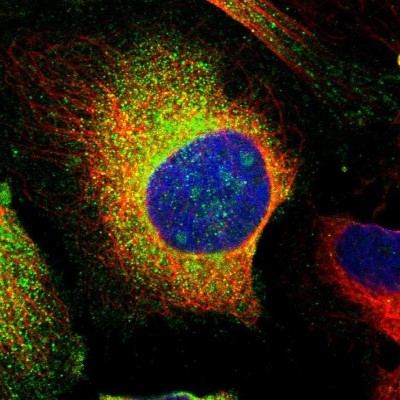 Immunocytochemistry/Immunofluorescence: PCNXL4 Antibody [NBP1-87597] - Staining of human cell line U-2 OS shows localization to cytosol.