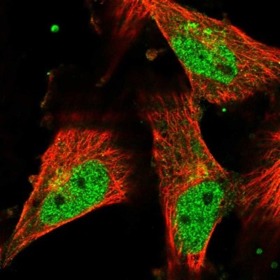 Immunocytochemistry/Immunofluorescence: SRCAP Antibody [NBP1-84063] - Staining of human cell line U-251 MG shows localization to nucleoplasm & the Golgi apparatus.