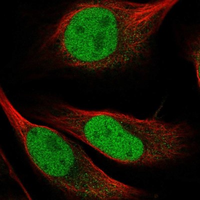 Immunocytochemistry/Immunofluorescence: HDGF2 Antibody [NBP2-47438] - Immunofluorescent staining of human cell line U-2 OS shows localization to nucleoplasm.