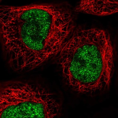 Immunocytochemistry/Immunofluorescence: RECQL4 Antibody [NBP2-47310] - Immunofluorescent staining of human cell line A-431 shows localization to nucleoplasm.