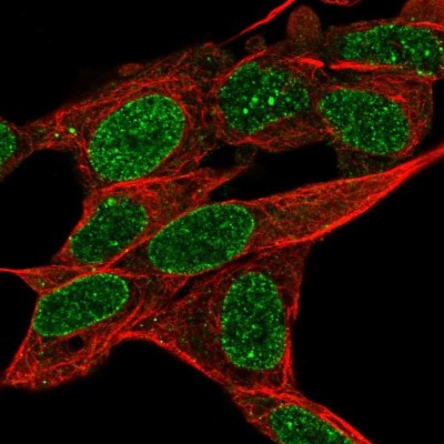 Immunocytochemistry/Immunofluorescence: RADIL Antibody [NBP2-49021] - Staining of human cell line SH-SY5Y shows localization to nucleoplasm & nuclear membrane.