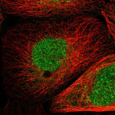 Immunocytochemistry/Immunofluorescence: Pirh2 Antibody [NBP1-90098] - Immunofluorescent staining of human cell line A-431 shows localization to nucleoplasm & cytosol.