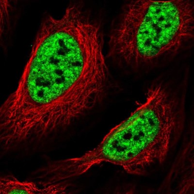 Immunocytochemistry/Immunofluorescence: SF3B2 Antibody [NBP1-92380] - Immunofluorescent staining of human cell line U-2 OS shows localization to nuclear speckles.