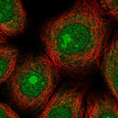 Immunocytochemistry/Immunofluorescence: ZNF354A Antibody [NBP2-13568] - Immunofluorescent staining of human cell line MCF7 shows localization to nucleus, nucleoli & cytosol.