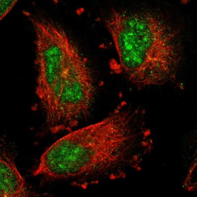 Immunocytochemistry/Immunofluorescence: IER5L Antibody [NBP1-88799] - Immunofluorescent staining of human cell line U-251 MG shows localization to nuclear speckles.