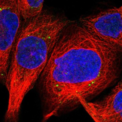 Immunocytochemistry/Immunofluorescence: PGBD2 Antibody [NBP1-85936] - Immunofluorescent staining of human cell line A-431 shows localization to vesicles.