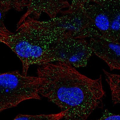 Immunocytochemistry/Immunofluorescence: MANBA Antibody [NBP2-47384] - Staining  human cell line A549 shows positivity in vesicles.